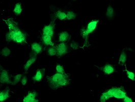 PMVK Antibody in Immunocytochemistry (ICC/IF)