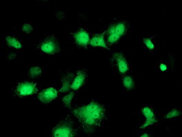 PMVK Antibody in Immunocytochemistry (ICC/IF)