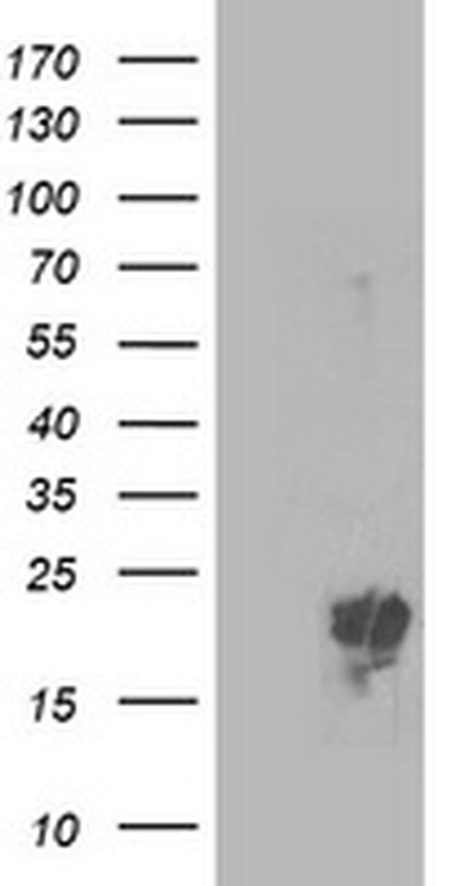 PMVK Antibody in Western Blot (WB)