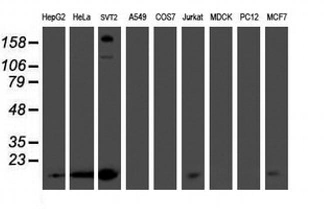 PMVK Antibody in Western Blot (WB)