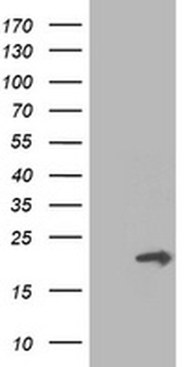 PMVK Antibody in Western Blot (WB)