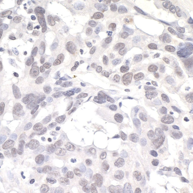 PNK1 Antibody in Immunohistochemistry (IHC)