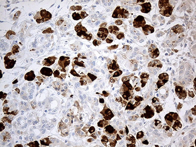 PNLIP Antibody in Immunohistochemistry (Paraffin) (IHC (P))