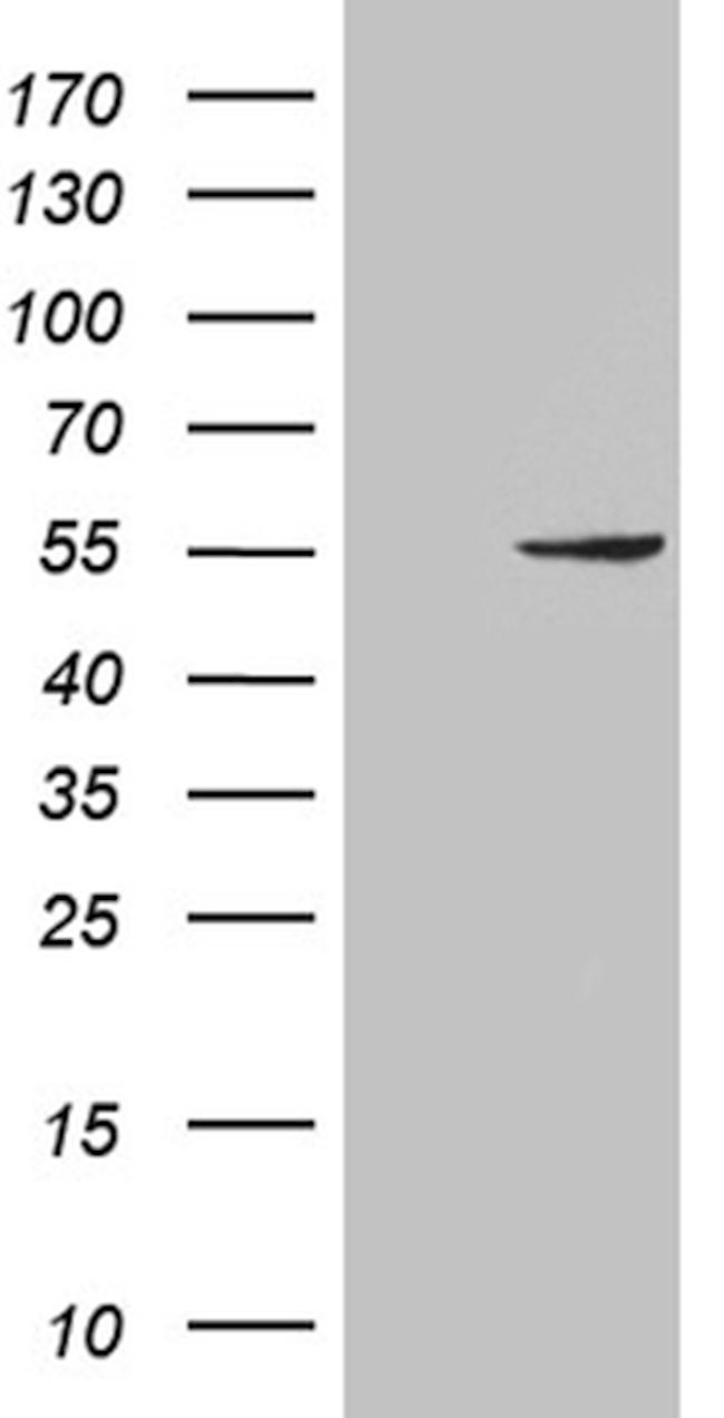 PNLIP Antibody in Western Blot (WB)