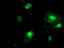 PNMT Antibody in Immunocytochemistry (ICC/IF)