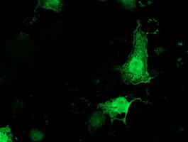 PNMT Antibody in Immunocytochemistry (ICC/IF)