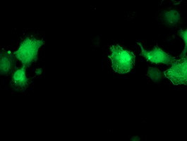 PNMT Antibody in Immunocytochemistry (ICC/IF)