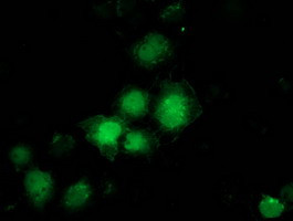 PNMT Antibody in Immunocytochemistry (ICC/IF)