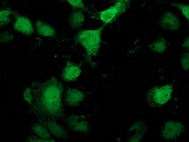 PNMT Antibody in Immunocytochemistry (ICC/IF)