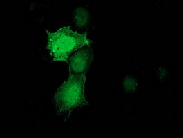 PNMT Antibody in Immunocytochemistry (ICC/IF)