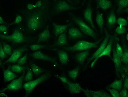 PNMT Antibody in Immunocytochemistry (ICC/IF)