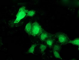 PNMT Antibody in Immunocytochemistry (ICC/IF)