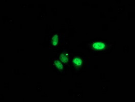 PNMT Antibody in Immunocytochemistry (ICC/IF)