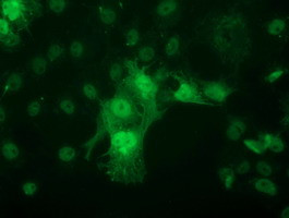 PNMT Antibody in Immunocytochemistry (ICC/IF)