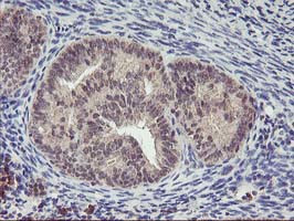 PNMT Antibody in Immunohistochemistry (Paraffin) (IHC (P))