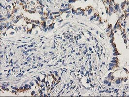 PNMT Antibody in Immunohistochemistry (Paraffin) (IHC (P))