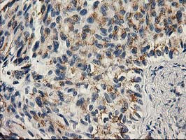 PNMT Antibody in Immunohistochemistry (Paraffin) (IHC (P))