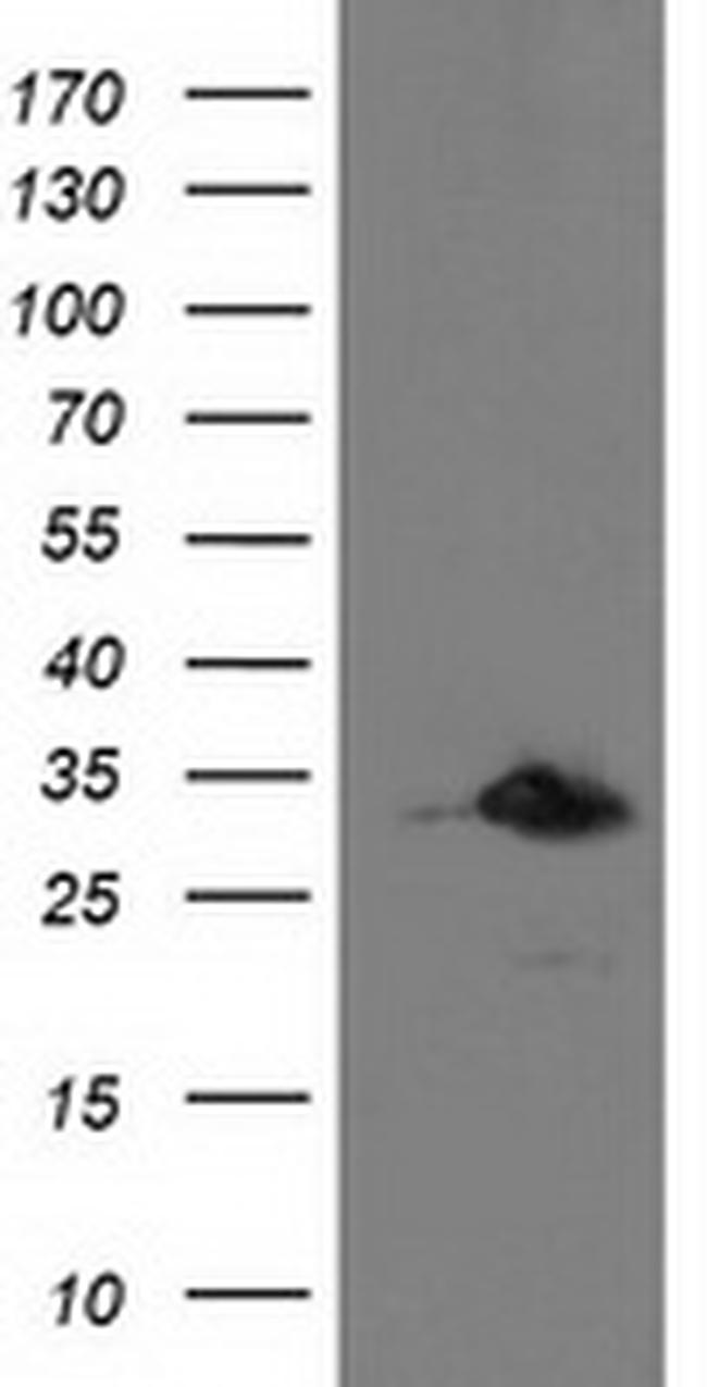 PNMT Antibody in Western Blot (WB)