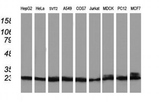 PNMT Antibody in Western Blot (WB)