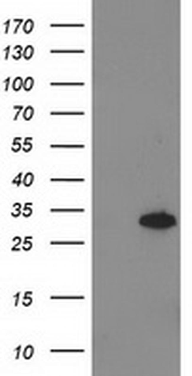 PNMT Antibody in Western Blot (WB)