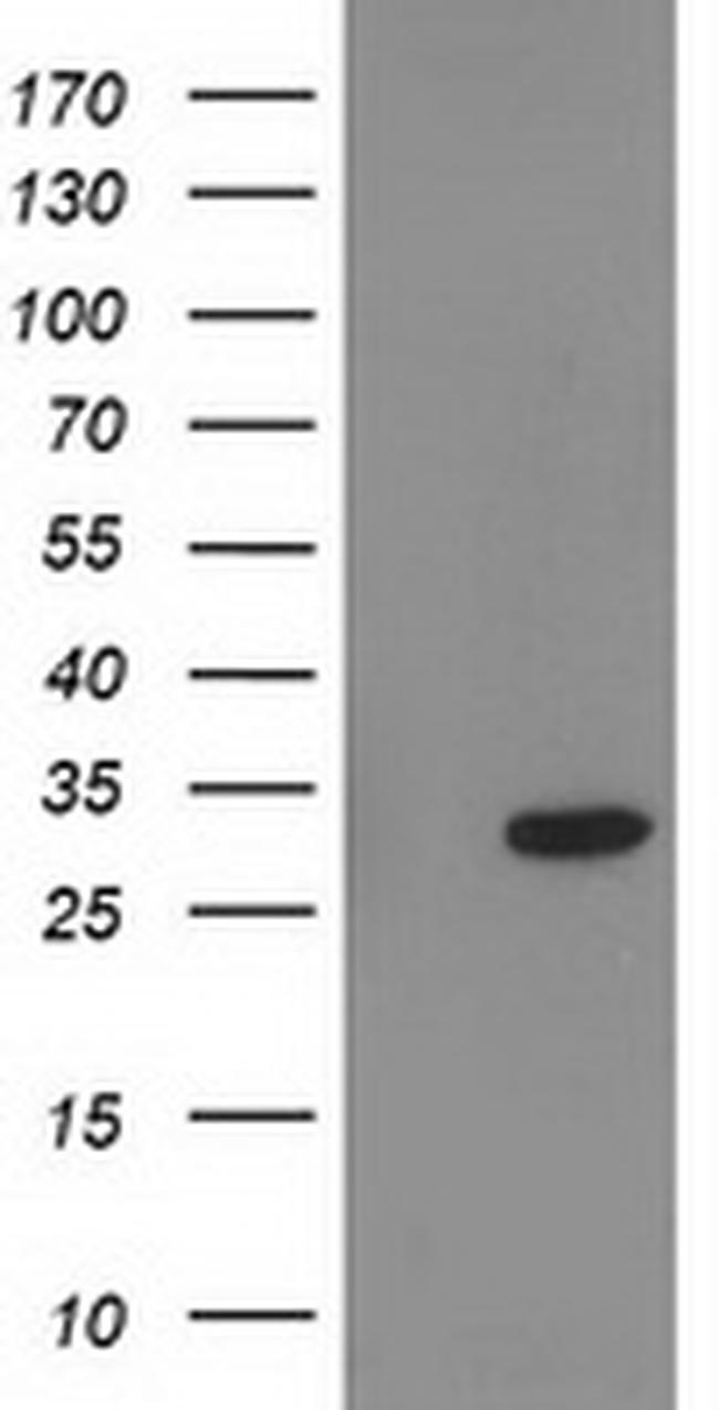 PNMT Antibody in Western Blot (WB)