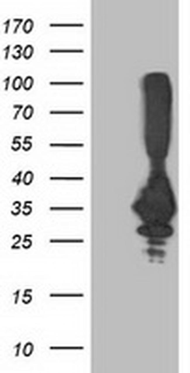 PNMT Antibody in Western Blot (WB)