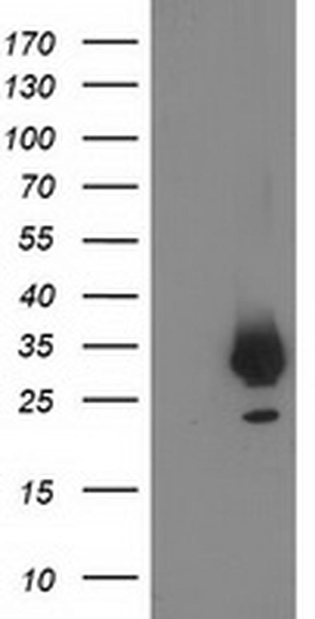 PNMT Antibody in Western Blot (WB)