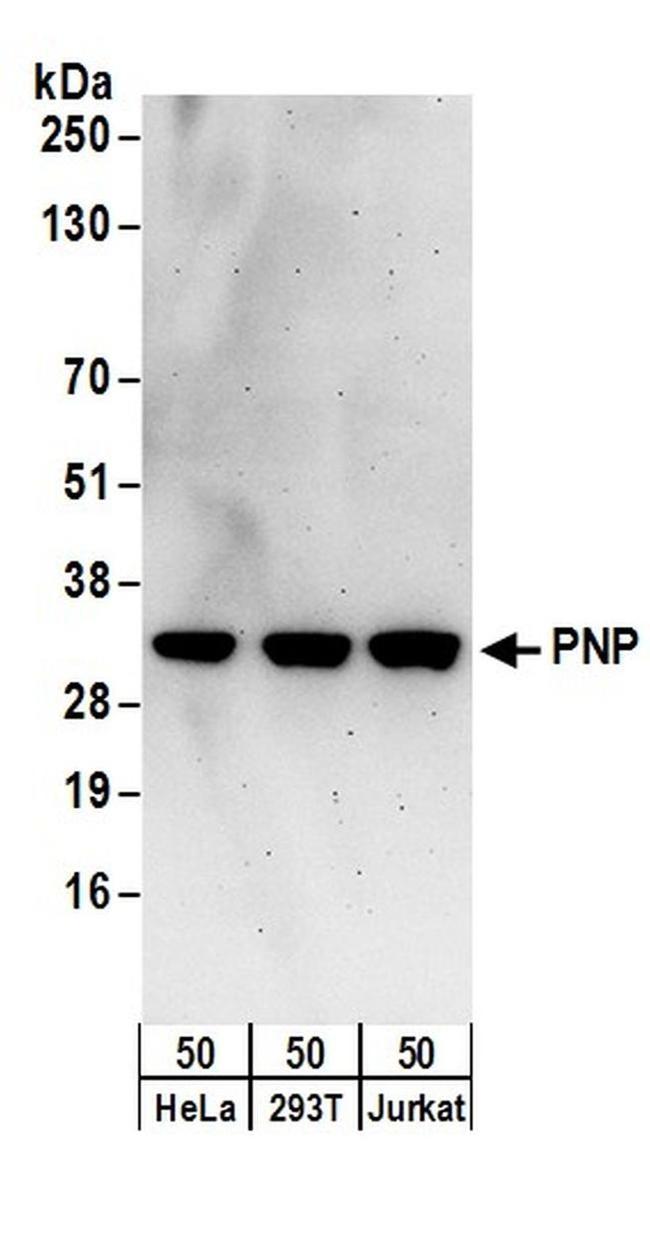 PNP Antibody in Western Blot (WB)