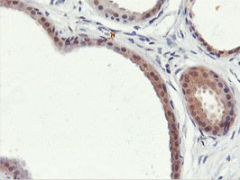 PNPO Antibody in Immunohistochemistry (Paraffin) (IHC (P))