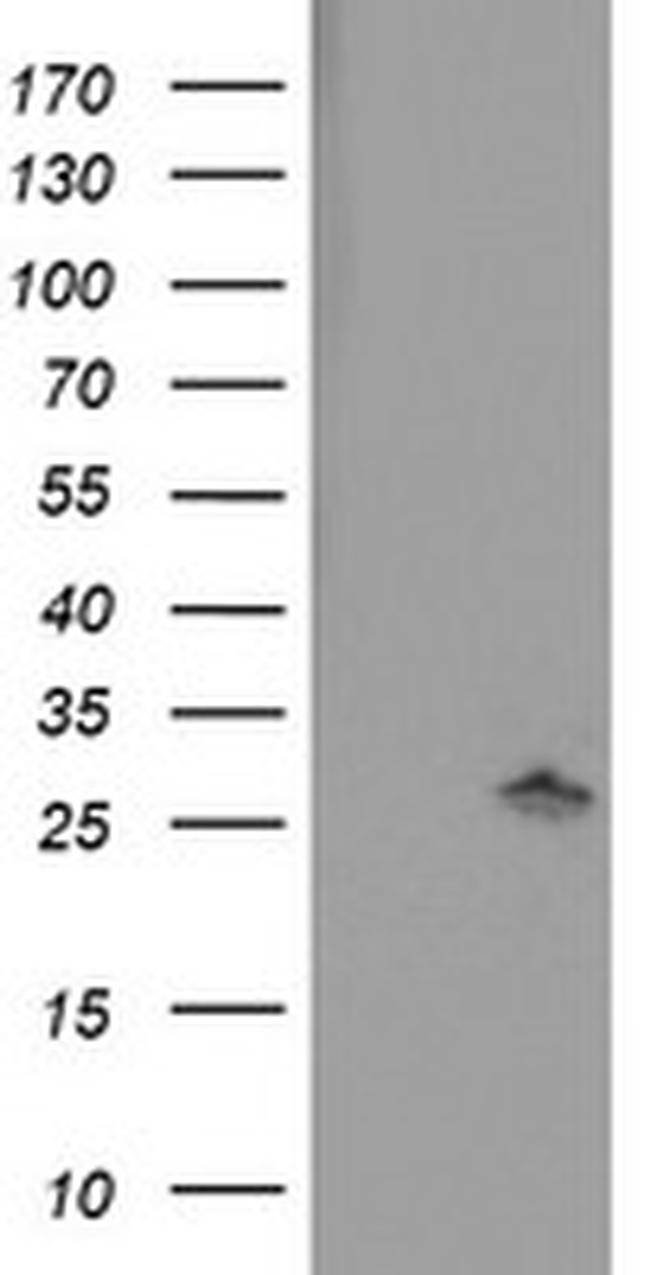 PNPO Antibody in Western Blot (WB)