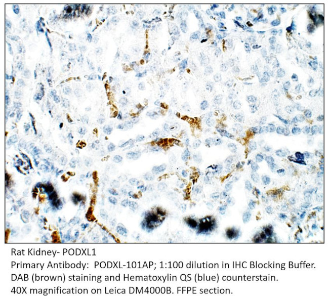 PODXL1 Antibody in Immunohistochemistry (IHC)