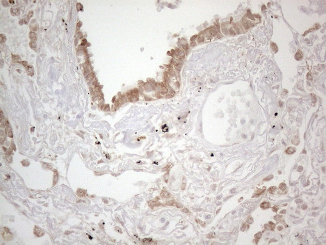 PODXL Antibody in Immunohistochemistry (Paraffin) (IHC (P))