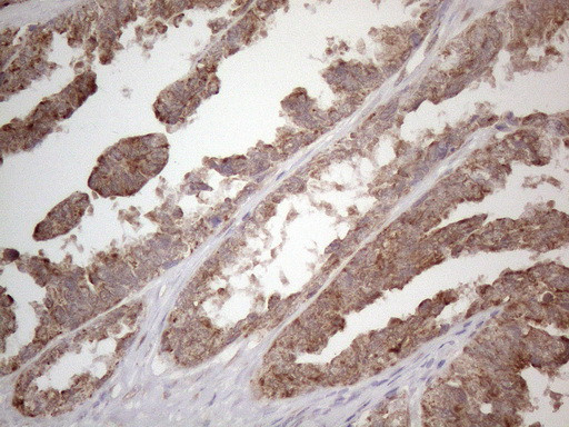 PODXL Antibody in Immunohistochemistry (Paraffin) (IHC (P))