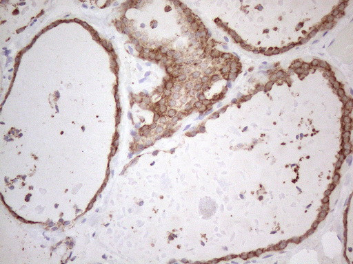 PODXL Antibody in Immunohistochemistry (Paraffin) (IHC (P))