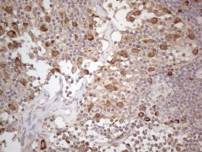 PODXL Antibody in Immunohistochemistry (Paraffin) (IHC (P))