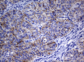 POLI Antibody in Immunohistochemistry (Paraffin) (IHC (P))