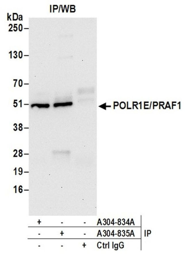 POLR1E/PRAF1 Antibody in Immunoprecipitation (IP)