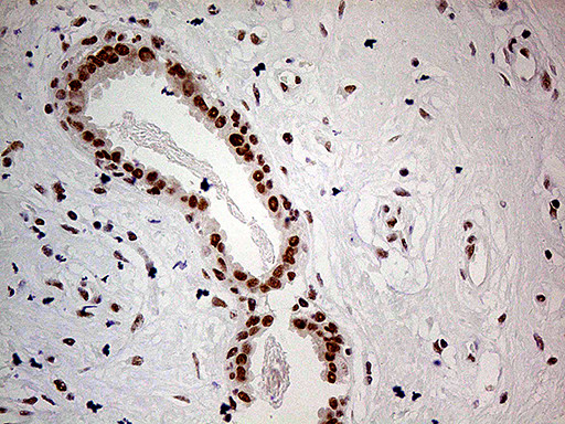 POLR2A Antibody in Immunohistochemistry (Paraffin) (IHC (P))