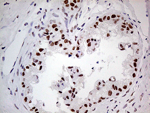 POLR2A Antibody in Immunohistochemistry (Paraffin) (IHC (P))