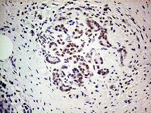 POLR2A Antibody in Immunohistochemistry (Paraffin) (IHC (P))