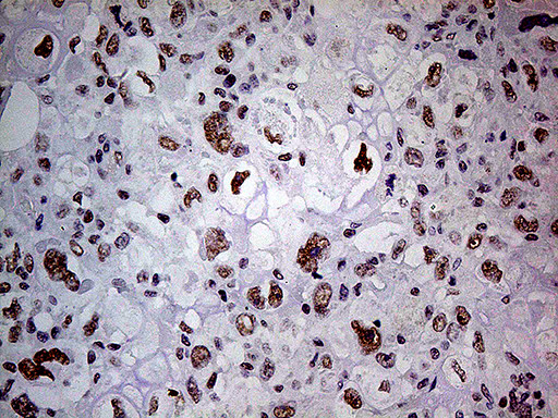 POLR2A Antibody in Immunohistochemistry (Paraffin) (IHC (P))