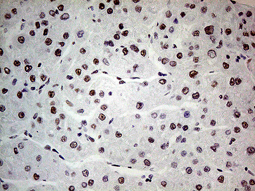 POLR2A Antibody in Immunohistochemistry (Paraffin) (IHC (P))