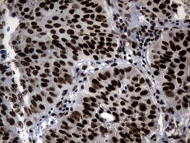 POLR2A Antibody in Immunohistochemistry (Paraffin) (IHC (P))