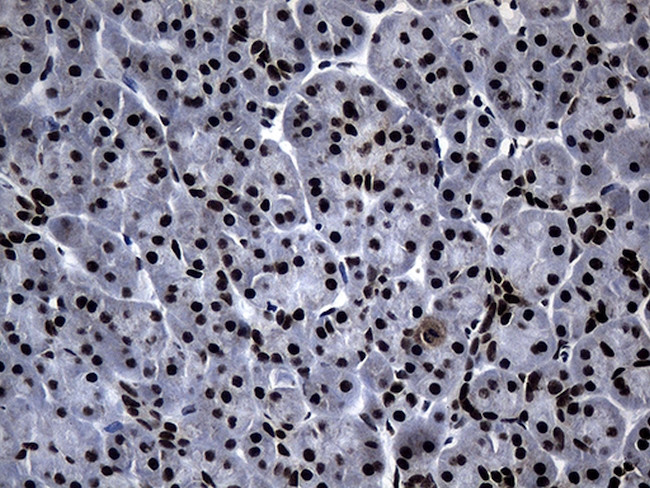 POLR2A Antibody in Immunohistochemistry (Paraffin) (IHC (P))