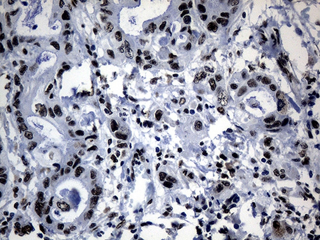 POLR2A Antibody in Immunohistochemistry (Paraffin) (IHC (P))