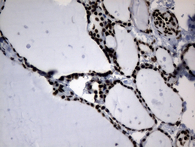 POLR2A Antibody in Immunohistochemistry (Paraffin) (IHC (P))