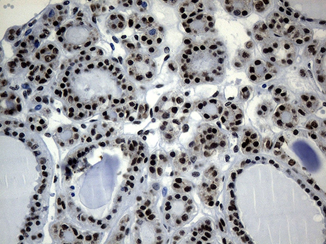 POLR2A Antibody in Immunohistochemistry (Paraffin) (IHC (P))