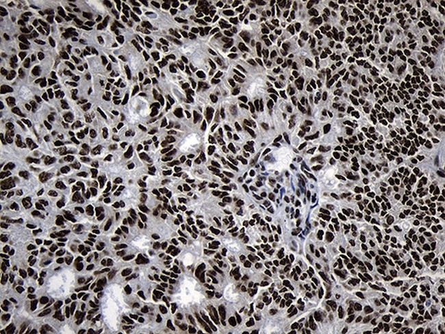 POLR2A Antibody in Immunohistochemistry (Paraffin) (IHC (P))