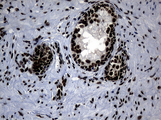 POLR2A Antibody in Immunohistochemistry (Paraffin) (IHC (P))