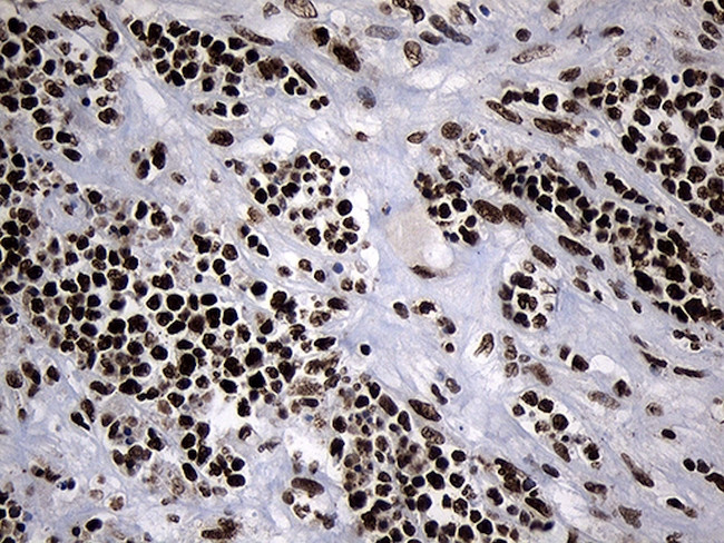 POLR2A Antibody in Immunohistochemistry (Paraffin) (IHC (P))